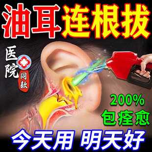 油耳朵清洁器专用滴耳液耳闷耳堵耳屎软化耵聍吸耳痒耳油清理神器